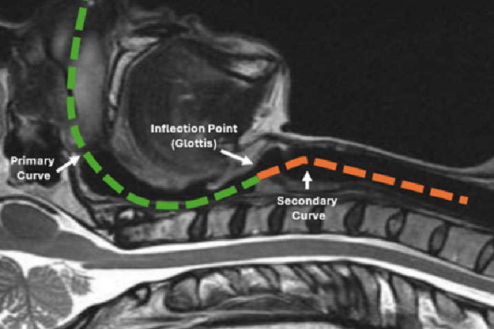 curve DPI thumb